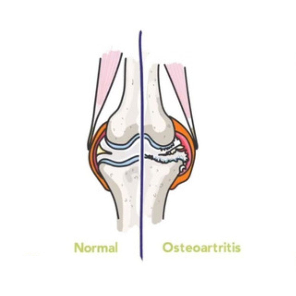 Flexadin Advance 60 Comprimidos Masticables